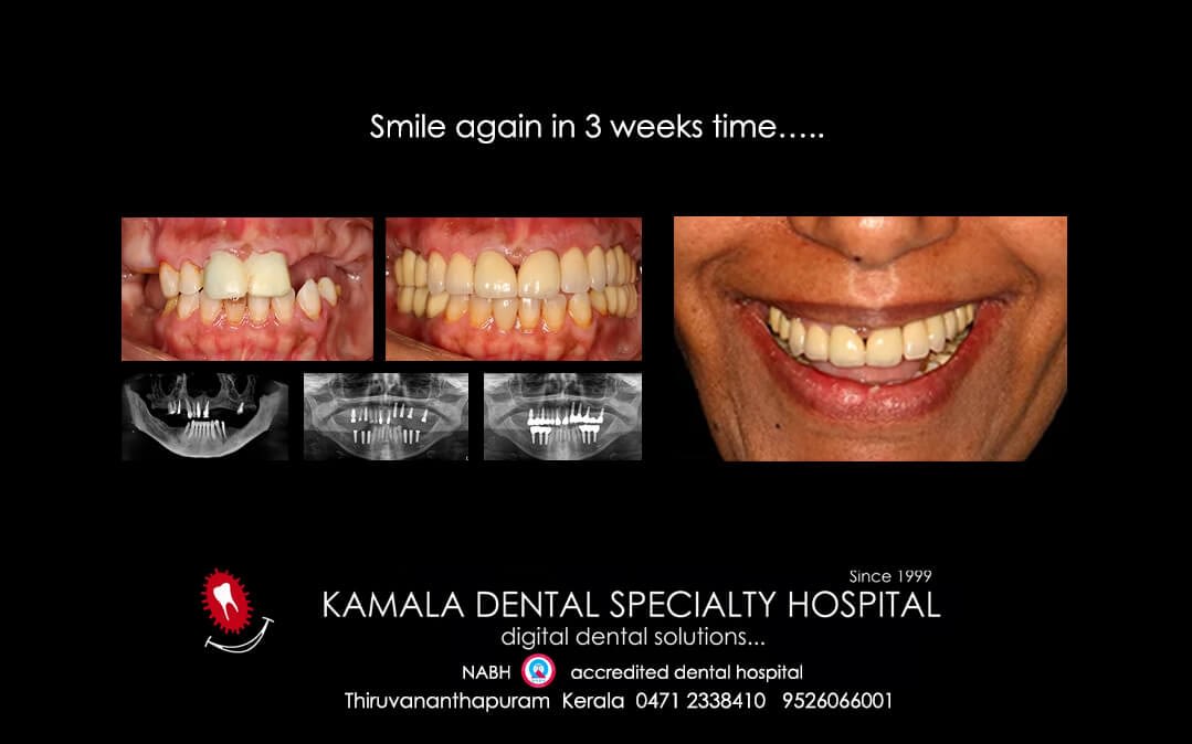Smile again in 3 weeks time…..