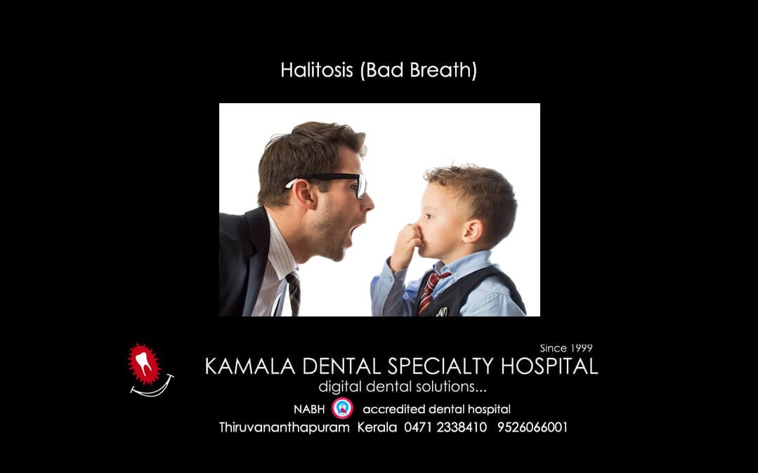 Halitosis(Bad Breath)