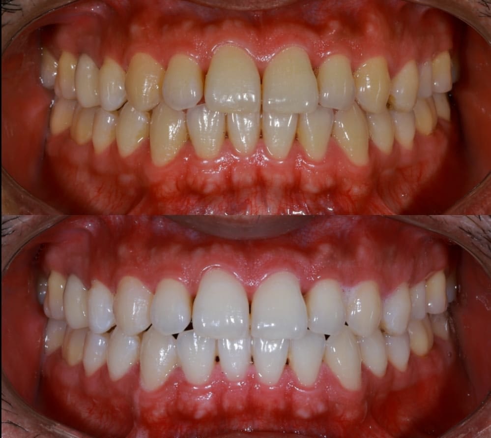 Smile Brighter’ at Kamala Dental Specialty Hospital